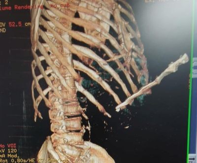 osa3.jpg.2b5de812c1dd3a4e0362740c642e6dbb.jpg