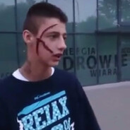 LEWY420