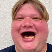 YoungS1mple